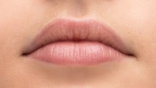Dry Lips Remedies