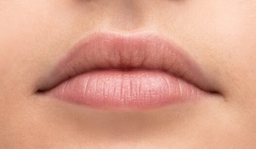 Dry Lips Remedies