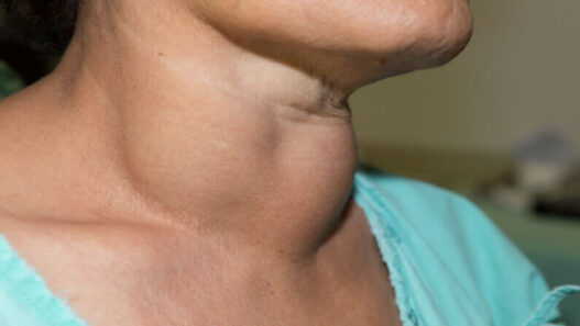 Thyroid Awareness Month 2024