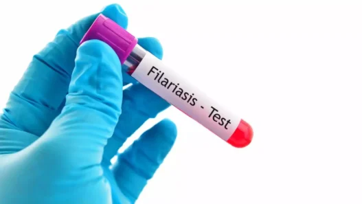 Yogi government in mission mode to make UP free from filariasis